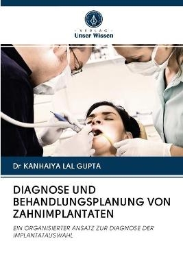 Diagnose Und Behandlungsplanung Von Zahnimplantaten - Dr KANHAIYA LAL GUPTA
