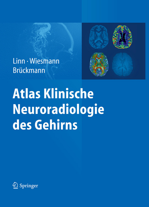 Atlas Klinische Neuroradiologie des Gehirns -  Jennifer Linn,  Martin Wiesmann,  Hartmut Brückmann