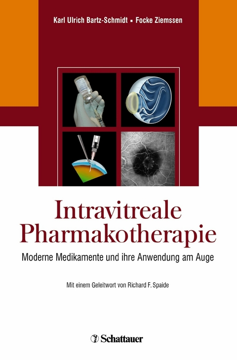 Intravitreale Pharmakotherapie -  Karl Ulrich Bartz-Schmidt