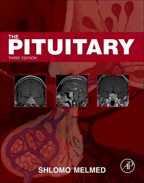 Pituitary - 