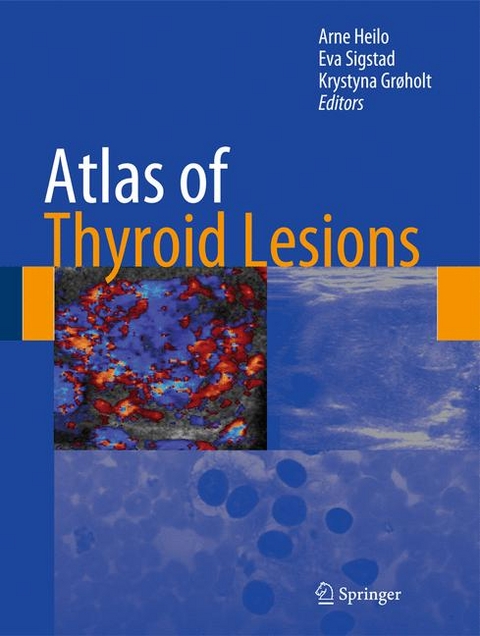 Atlas of Thyroid Lesions - 