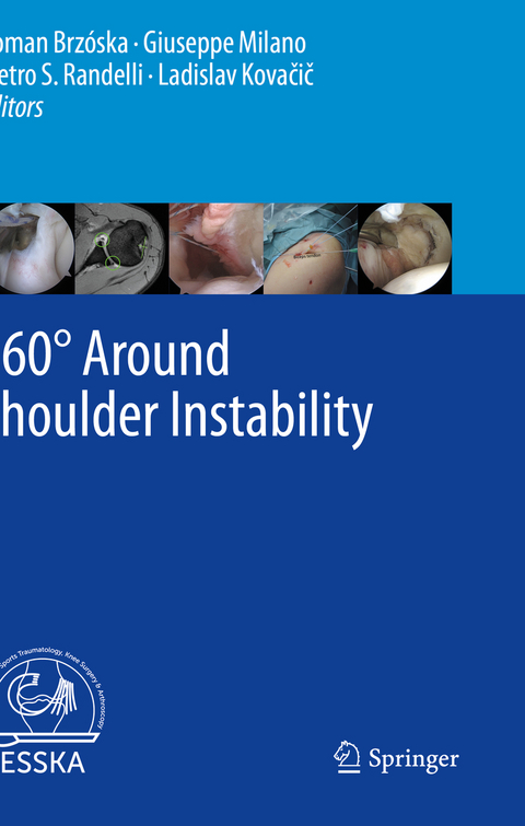 360&deg; Around Shoulder Instability - 