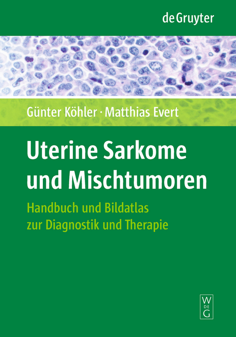 Uterine Sarkome und Mischtumoren - G&uuml;nter K&ouml;hler, Matthias Evert