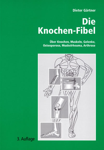 Die Knochen-Fibel: &Uuml;ber Knochen, Muskeln, Gelenke, Osteoporose, Muskelrheuma, Arthrose. Ein kleines orthop&auml;disches Lehrbuch f&uuml;r den Laien -  Dieter G&auml;rtner