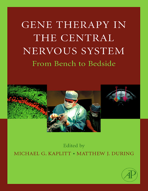Gene Therapy of the Central Nervous System: From Bench to Bedside - 