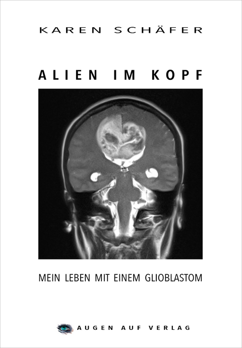 Alien im Kopf - Karen Sch&auml;fer
