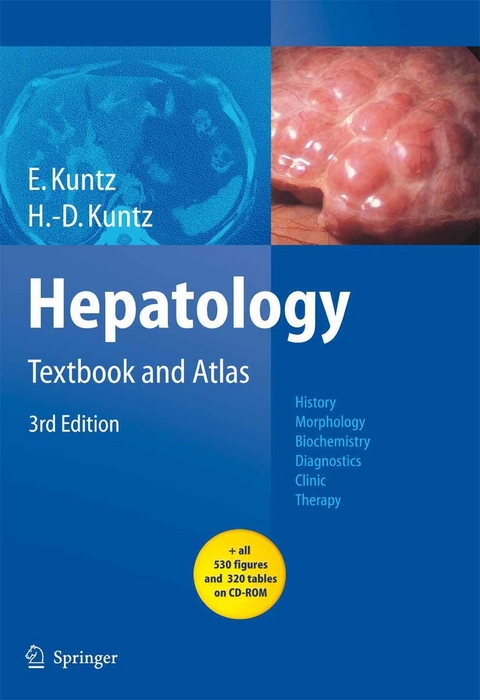 Hepatology -  Erwin Kuntz,  Hans-Dieter Kuntz