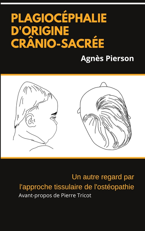 plagioc&eacute;phalie d'origine cr&acirc;nio-sacr&eacute;e - Agn&egrave;s Pierson