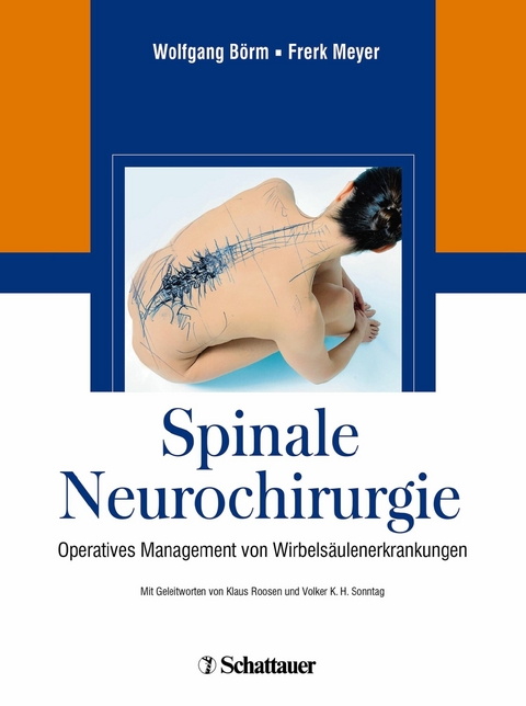 Spinale Neurochirurgie -  Wolfgang B&ouml;rm