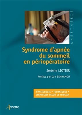 Syndrome d'apn&eacute;e du sommeil en p&eacute;riop&eacute;ratoire : physiologie, techniques, strat&eacute;gies selon le terrain - J&eacute;r&ocirc;me Liotier