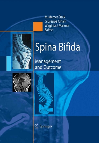 Spina Bifida