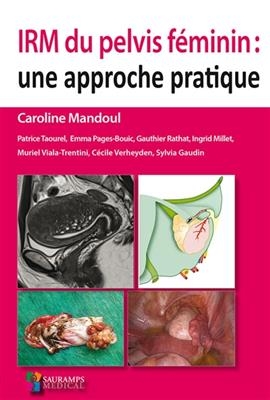 IRM du pelvis féminin : une approche pratique