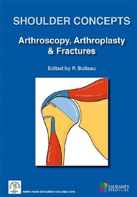 Shoulder concepts 2018 : arthroscopy, arthroplasty & fractures -  Nice shoulder course