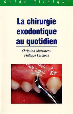 CHIRURGIE EXODONTIQUE AU QUOTIDIEN -LA-