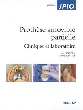 PROTHESE AMOVIBLE PARTIELLE -  SCHITTLY