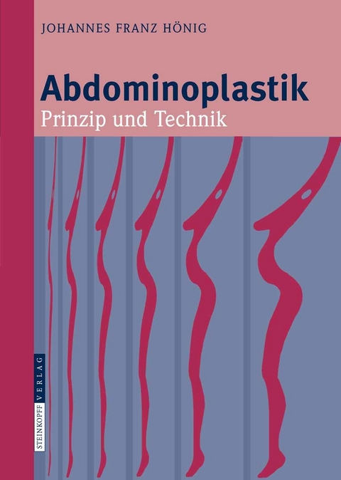 Abdominoplastik - Johannes-Franz H&ouml;nig
