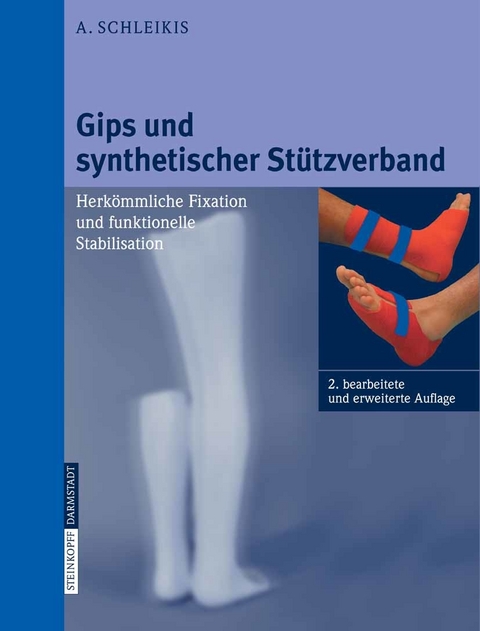 Gips und synthetischer St&uuml;tzverband - A. Schleikis