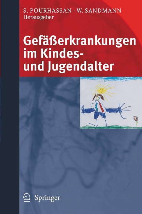 Gef&auml;&szlig;erkrankungen im Kindes- und Jugendalter - 