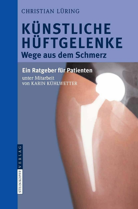 K&uuml;nstliche H&uuml;ftgelenke - C. L&uuml;ring