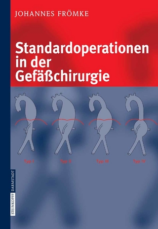 Standardoperationen in der Gefäßchirurgie