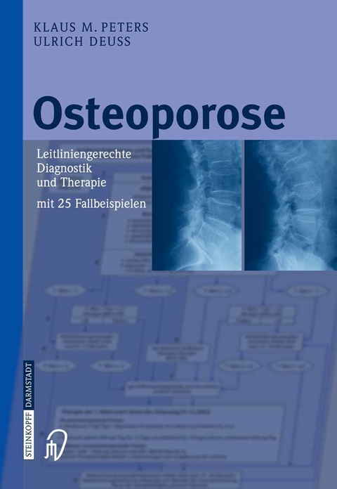 Osteoporose - Klaus M. Peters, Ulrich Deu&szlig;