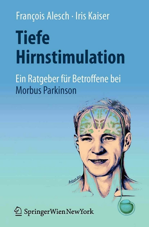 Tiefe Hirnstimulation: Ein Ratgeber f&uuml;r Betroffene bei Morbus Parkinson - Fran&ccedil;ois Alesch, Iris Kaiser