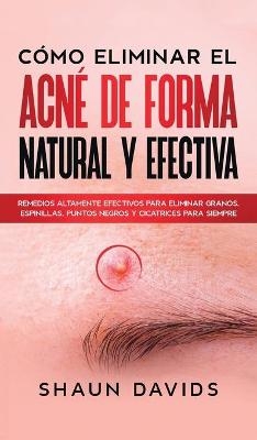 C&oacute;mo Eliminar el Acn&eacute; de Forma Natural y Efectiva - Shaun Davids