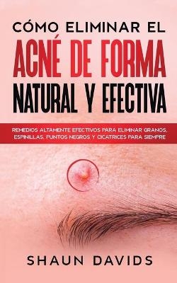 C&oacute;mo Eliminar el Acn&eacute; de Forma Natural y Efectiva - Shaun Davids