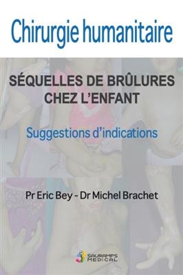 Chirurgie humanitaire : séquelles de brûlures chez l'enfant, suggestions d'indications : 20 ans d'expérience en Asie ...