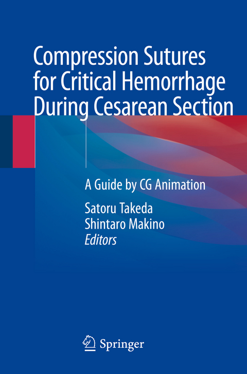 Compression Sutures for Critical Hemorrhage During Cesarean Section - 