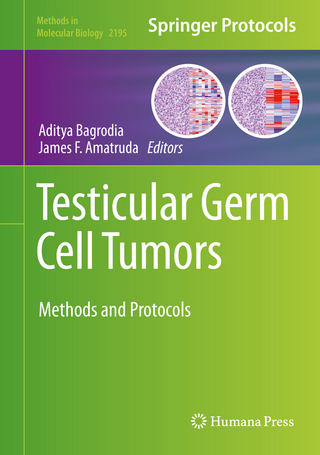 Testicular Germ Cell Tumors