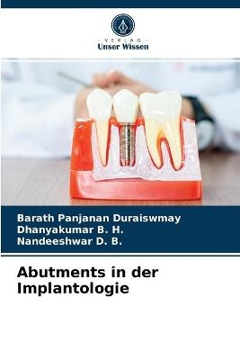 Abutments in der Implantologie - Barath Panjanan Duraiswmay, Dhanyakumar B H, Nandeeshwar D B