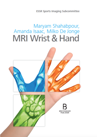 MRI Wrist & Hand
