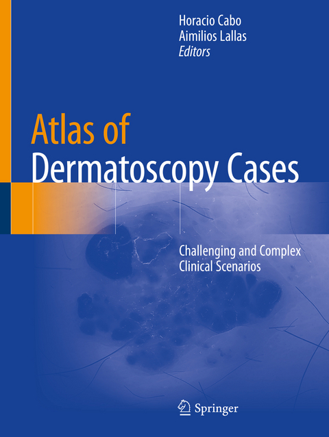 Atlas of Dermatoscopy Cases - 