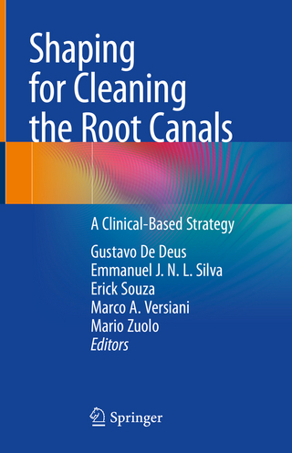 Shaping for Cleaning the Root Canals