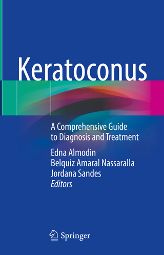 Keratoconus