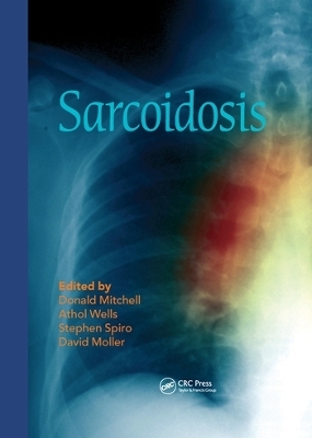 Sarcoidosis - 