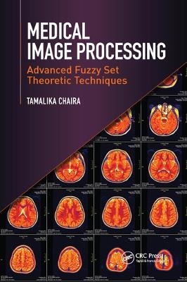 Medical Image Processing - Tamalika Chaira