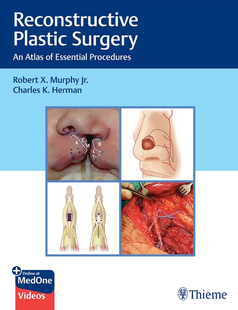Reconstructive Plastic Surgery - 