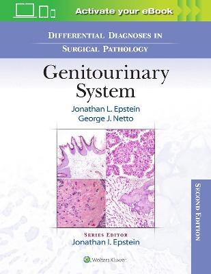 Differential Diagnoses in Surgical Pathology: Genitourinary System - Jonathan Epstein, George J. Netto