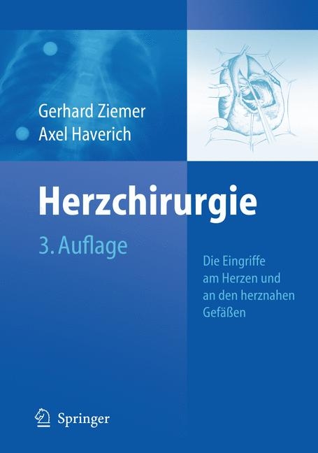 Herzchirurgie -  Axel Haverich,  Gerhard Ziemer