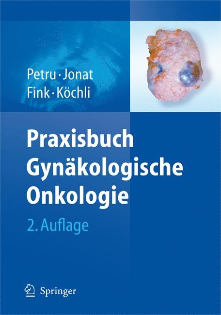 Praxisbuch Gyn&auml;kologische Onkologie - 