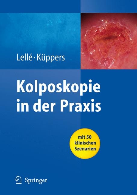Kolposkopie in der Praxis - Ralph J. Lell&eacute;, Volkmar K&uuml;ppers