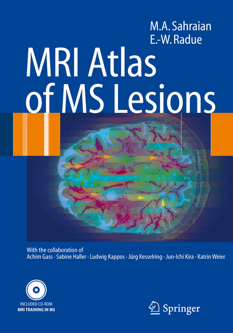 MRI Atlas of MS Lesions - M.A. Sahraian, Ernst-Wilhelm Rad&uuml;