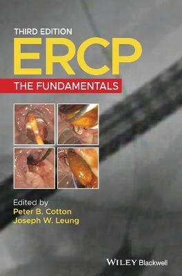 ERCP