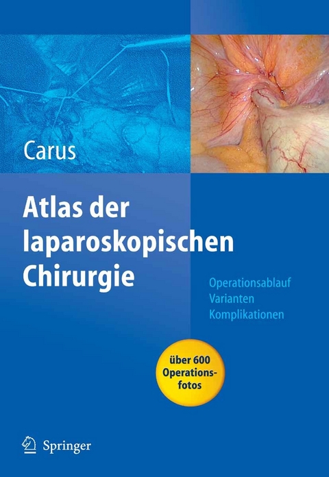 Operationsatlas Laparoskopische Chirurgie - Thomas Carus
