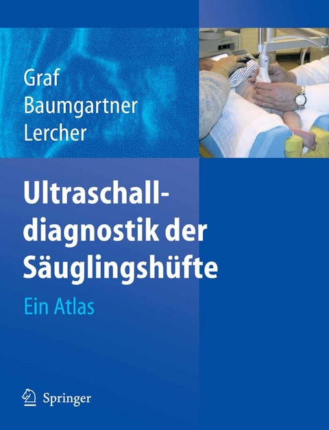 Ultraschalldiagnostik der S&auml;uglingsh&uuml;fte - R. Graf, F. Baumgartner, K. Lercher