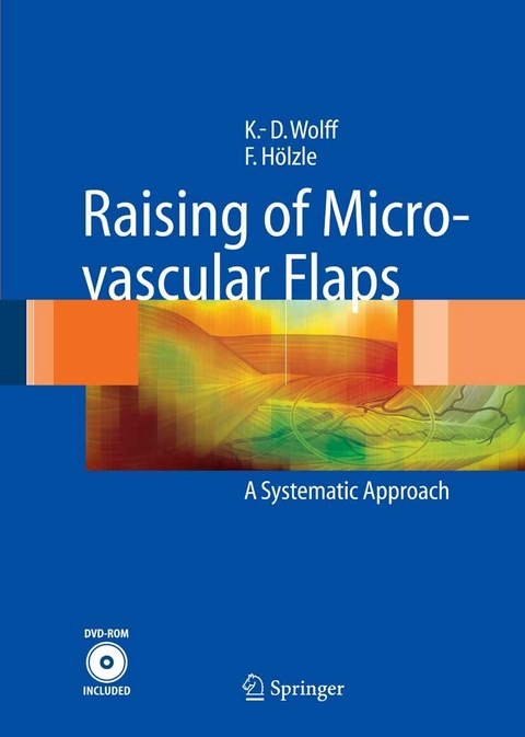 Raising of Microvascular Flaps -  Klaus-Dietrich Wolff,  Frank H&ouml;lzle
