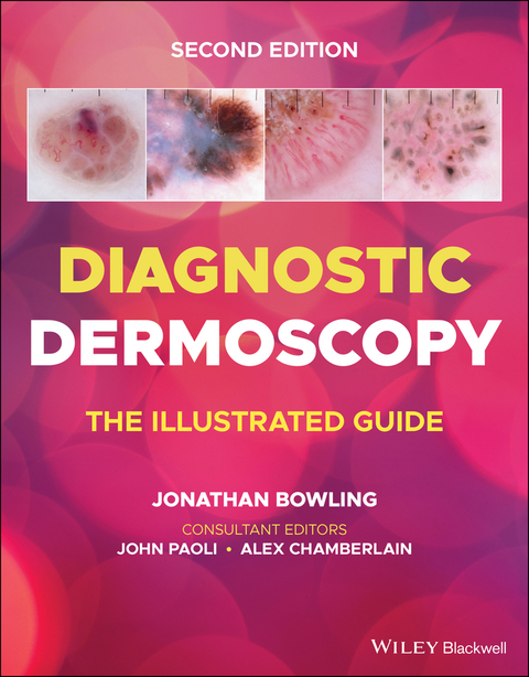 Diagnostic Dermoscopy - 