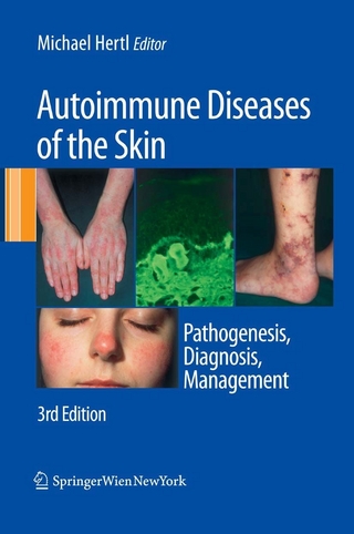 Autoimmune Diseases of the Skin